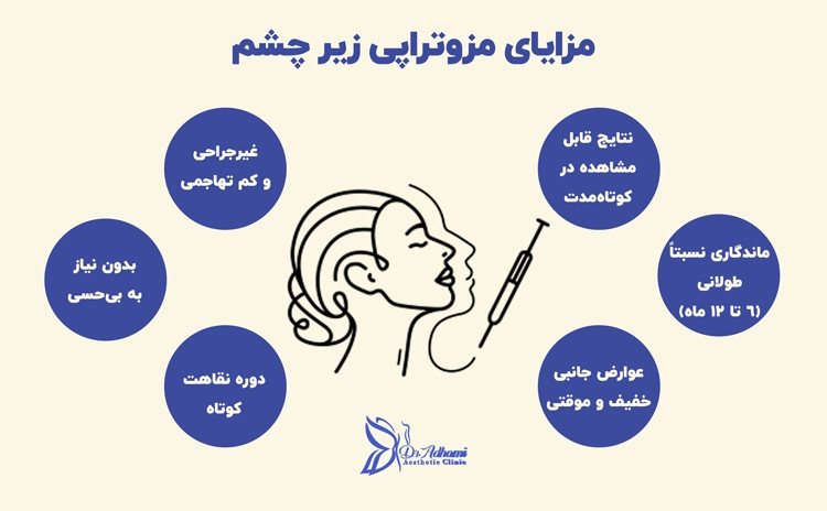 مزایای مزوتراپی زیر چشم