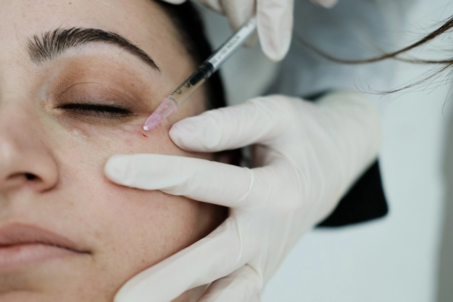 مزوتراپی گودی زیر چشم
