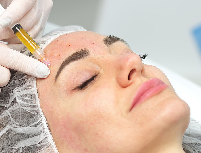 تفاوت مزوژل و مزوتراپی